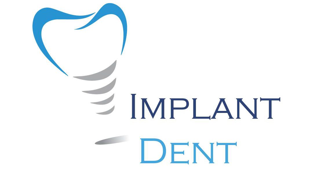 Implant Dent